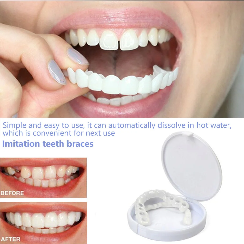 Teeth Whitening With Braces - Sdottor Fałszywe zęby Sztuczne aparaty ortodontyczne