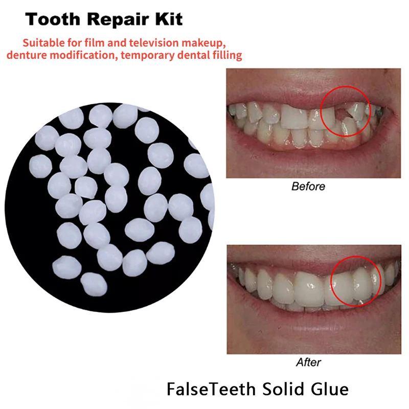 Teeth Whitening At Home - Klej do naprawy zębów kształtujący tymczasowe