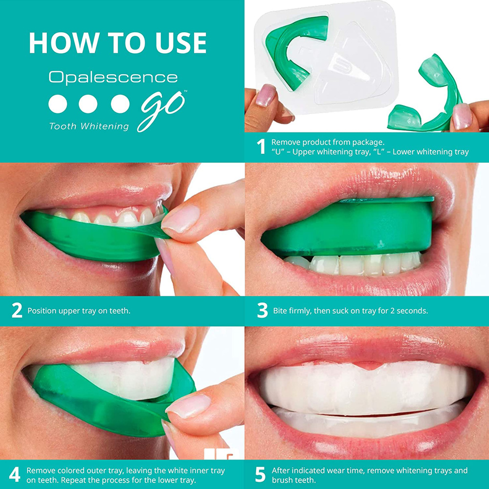 Nadtlenek wodoru do wybielania – Teeth Whitening At Home recenzja i cena