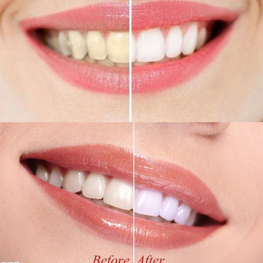 Bambusowy węgiel drzewny zęby  – Teeth Whitening Price recenzja i cena