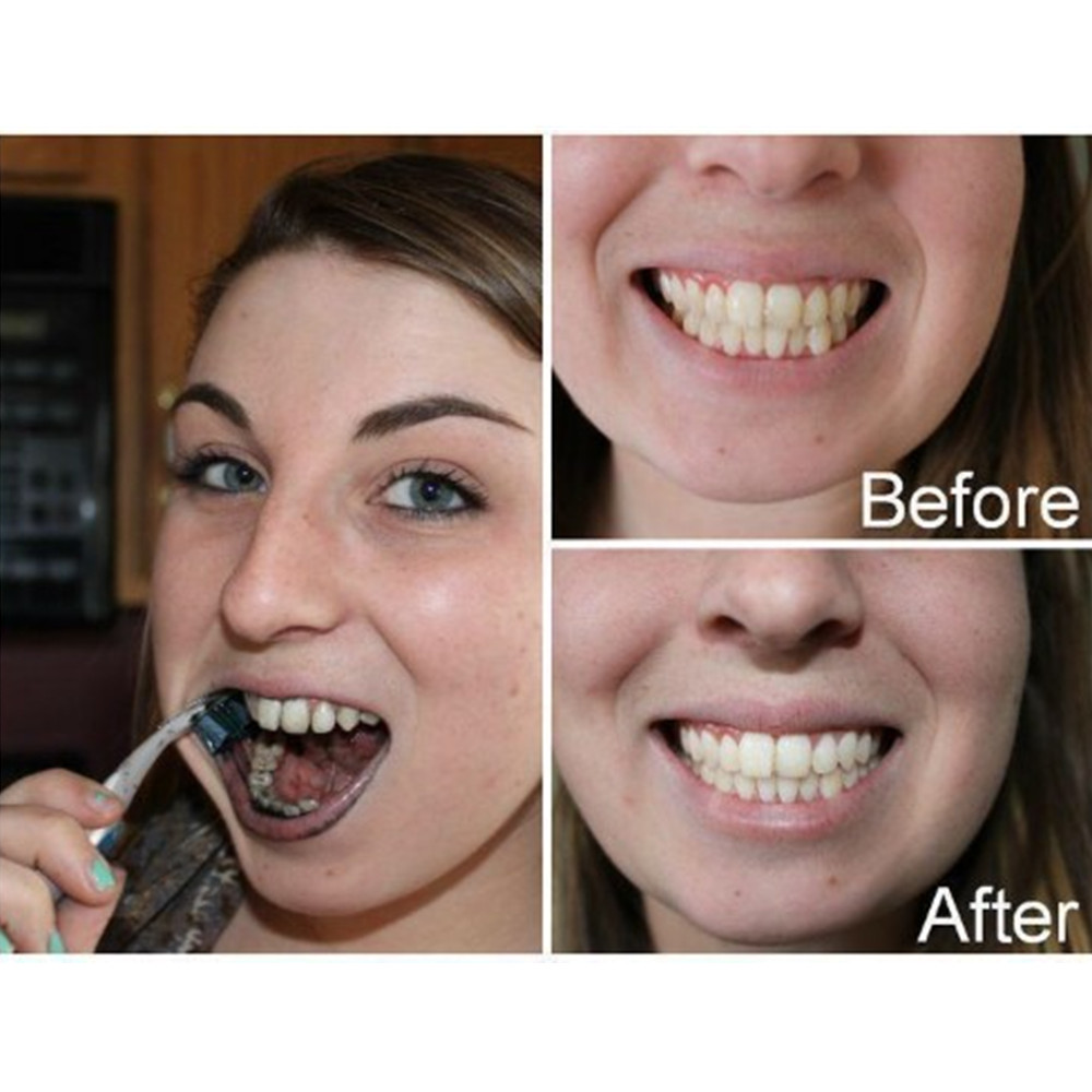 Bambusowy węgiel drzewny zęby  – Teeth Whitening Price recenzja i cena