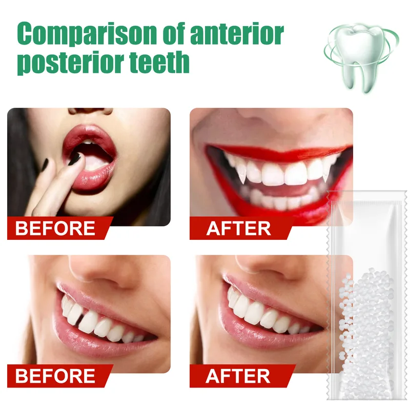 10g50g/30ml Klej do naprawy zę – Teeth Whitening At Home recenzja i cena