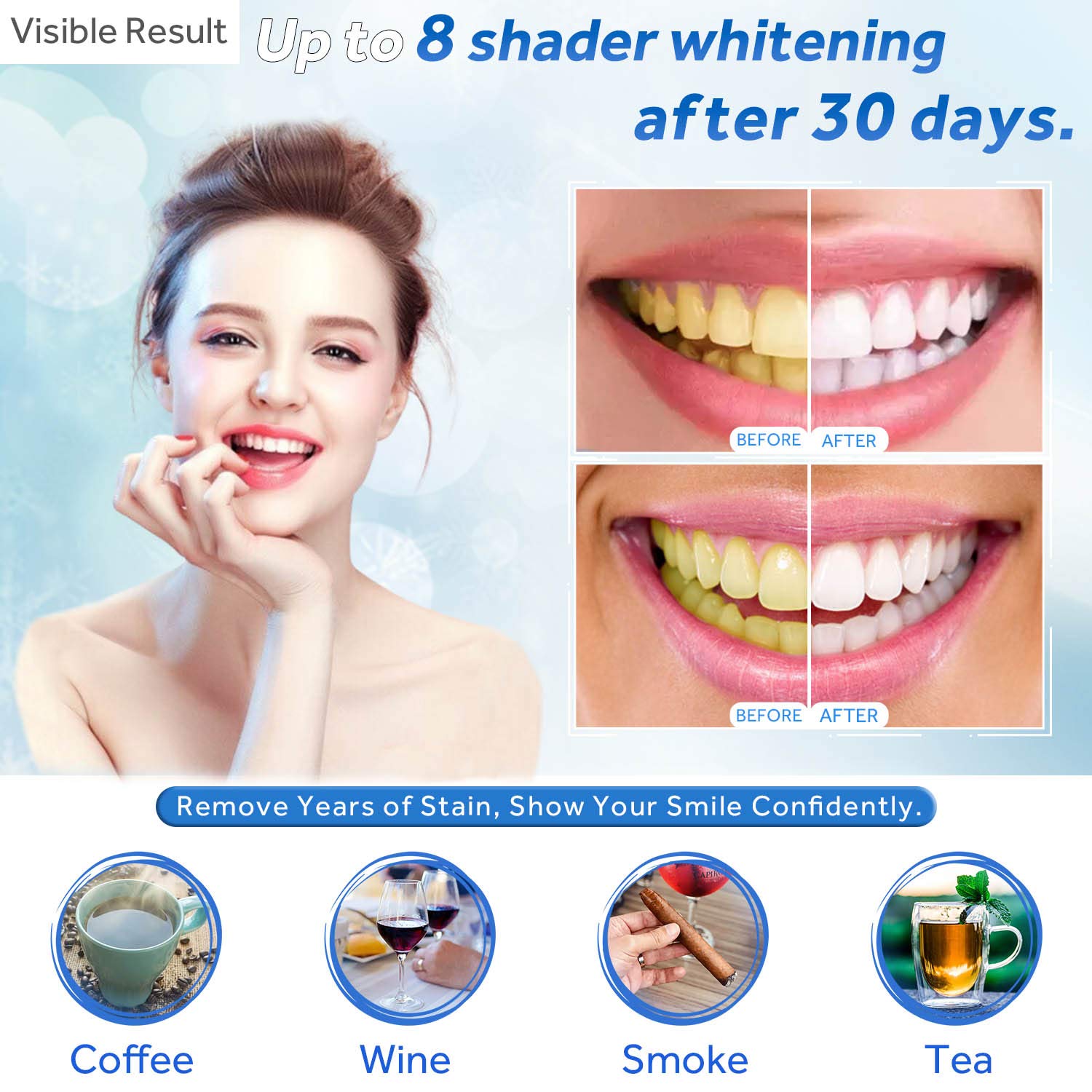 Żel do wybielania zębów w strz – Teeth Whitening At Home recenzja i cena