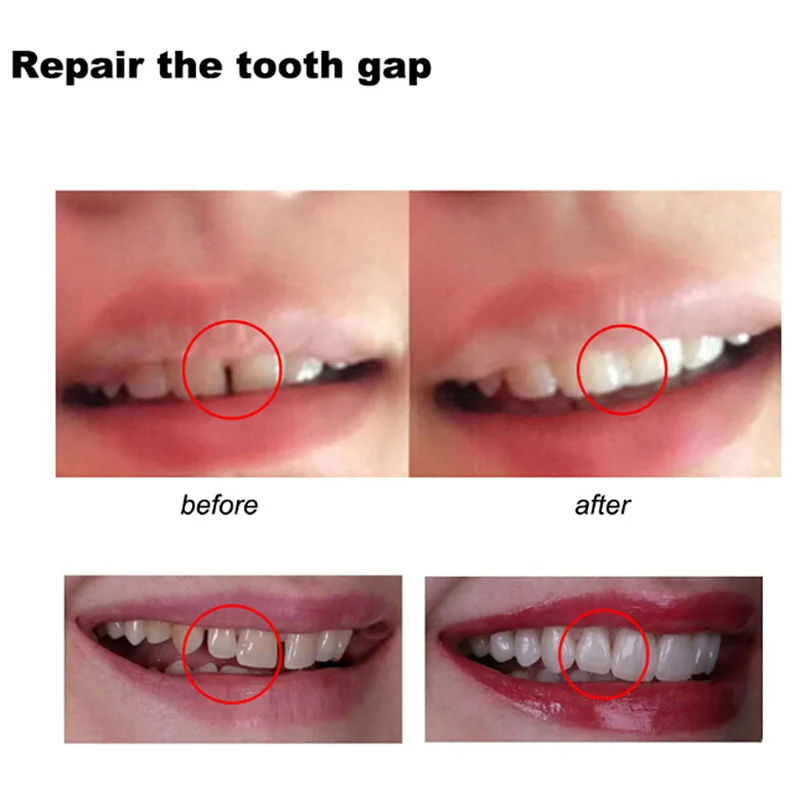 Klej do naprawy zębów kształtu – Teeth Whitening At Home recenzja i cena