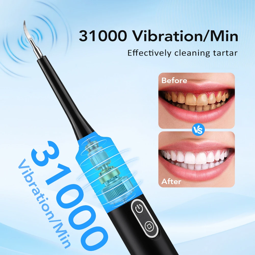 Elektryczny soniczny skaler de – Electric Toothbrush Sonic recenzja i cena